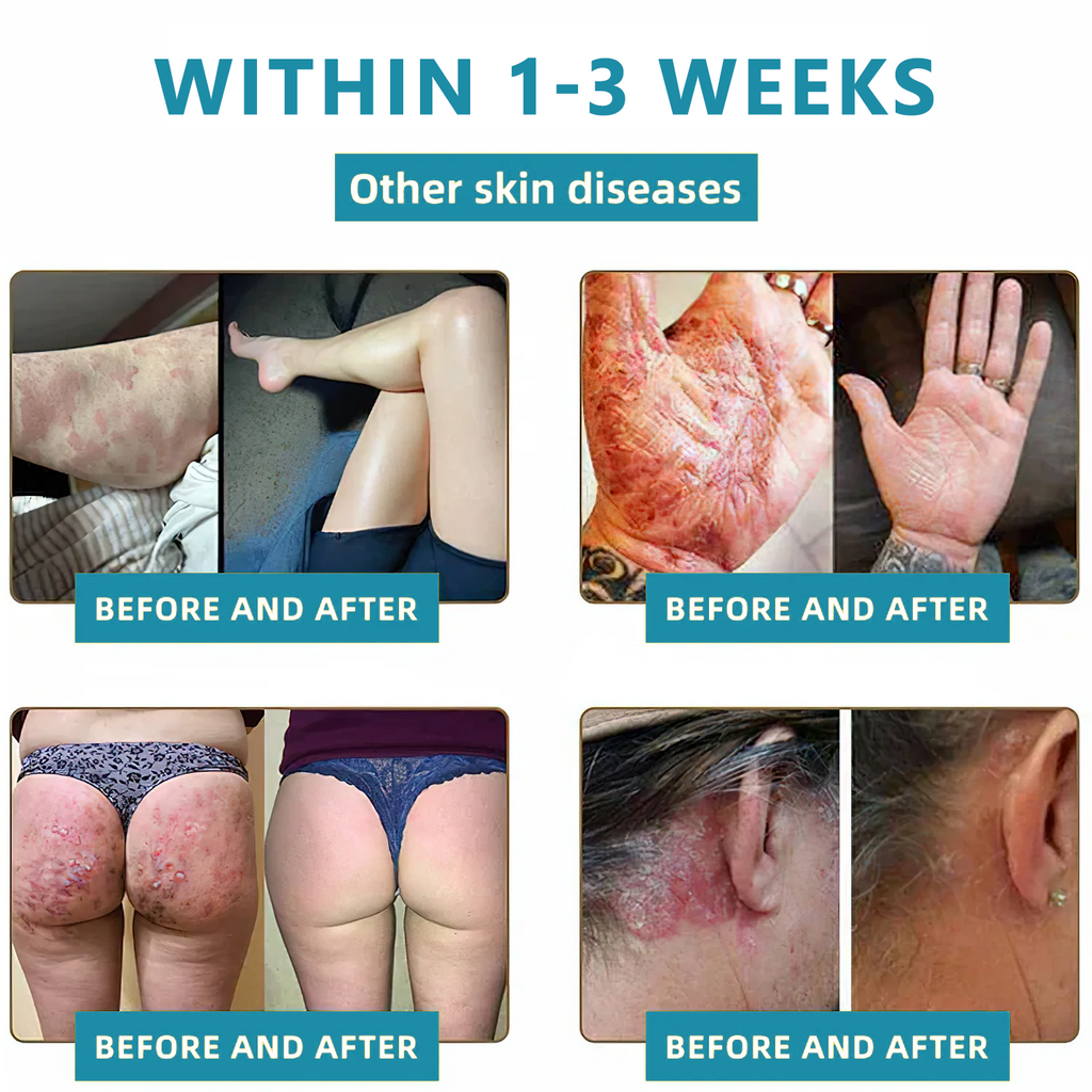 Total Skin Confidence Starts Here✨𝗞ı𝗱s𝗻𝗲𝗲𝗱® 𝗡𝗼𝗻-𝗜𝗻𝘃𝗮𝘀𝗶𝘃𝗲 𝗠𝗼𝗜𝗲 𝗮𝗻𝗱 𝗪𝗮𝗿𝘁 𝗥𝗲𝗺𝗼𝘃𝗮𝗜 𝗜𝗮𝘀𝗲𝗿 𝗣𝗲𝗻👨‍⚕️
