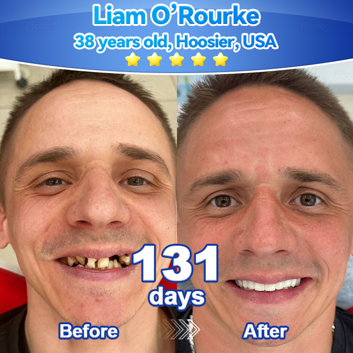 𝑃𝑖𝑐𝑑𝑜® 𝑆𝑡𝑒𝑚 𝐶𝑒𝑙𝑙 𝐺𝑖𝑛𝑔𝑖𝑣𝑎𝑙 𝑅𝑒𝑝𝑎𝑖𝑟 𝑀𝑜𝑢𝑠𝑠𝑒👩‍⚕️(Promote Tooth Regrowth • Remove Tartar • Strengthen Gums • Deep Clean & Freshen Breath) 🦷