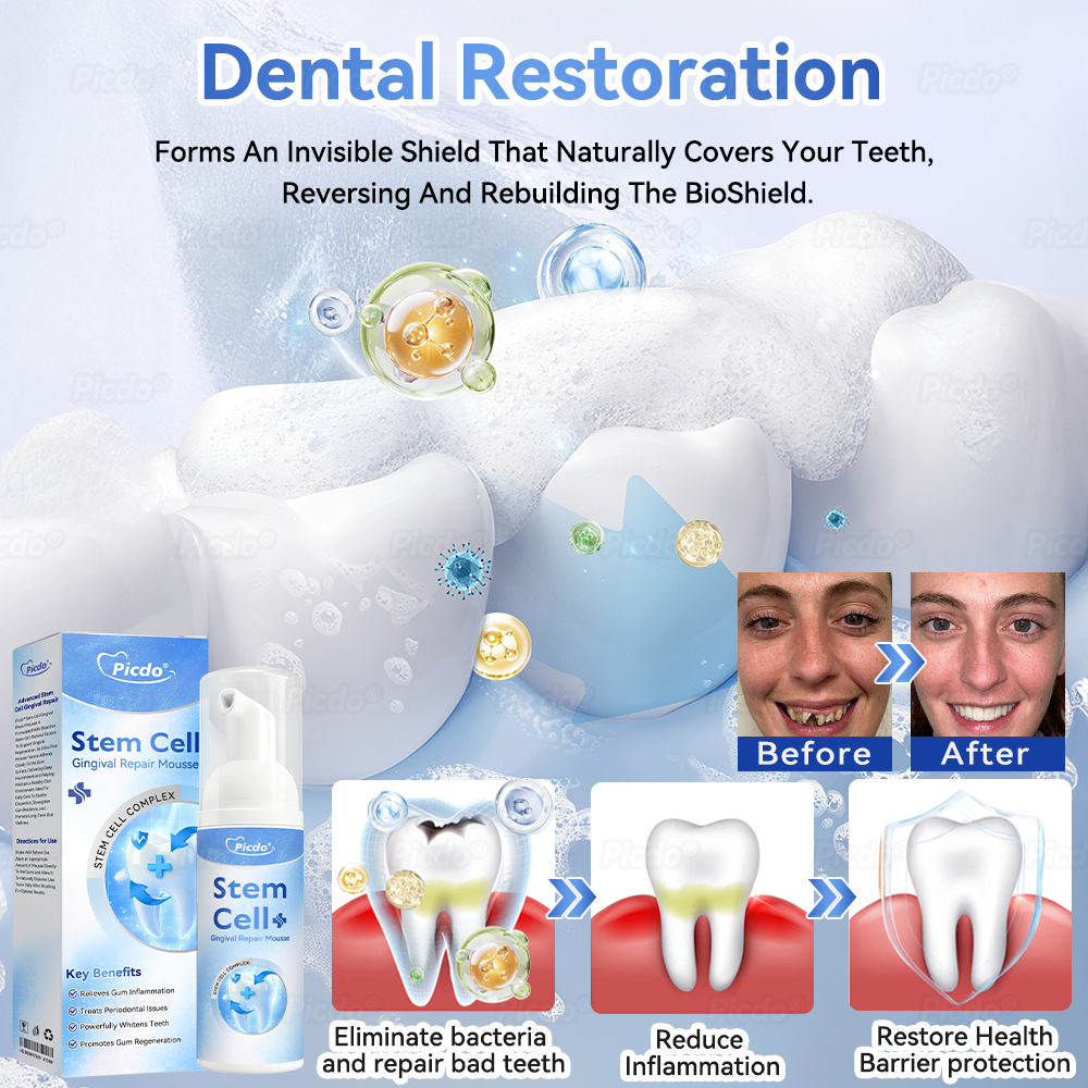 𝑃𝑖𝑐𝑑𝑜® 𝑆𝑡𝑒𝑚 𝐶𝑒𝑙𝑙 𝐺𝑖𝑛𝑔𝑖𝑣𝑎𝑙 𝑅𝑒𝑝𝑎𝑖𝑟 𝑀𝑜𝑢𝑠𝑠𝑒👩‍⚕️(Promote Tooth Regrowth • Remove Tartar • Strengthen Gums • Deep Clean & Freshen Breath) 🦷