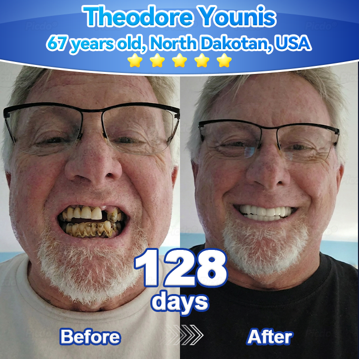 𝑃𝑖𝑐𝑑𝑜® 𝑆𝑡𝑒𝑚 𝐶𝑒𝑙𝑙 𝐺𝑖𝑛𝑔𝑖𝑣𝑎𝑙 𝑅𝑒𝑝𝑎𝑖𝑟 𝑀𝑜𝑢𝑠𝑠𝑒👩‍⚕️(Promote Tooth Regrowth • Remove Tartar • Strengthen Gums • Deep Clean & Freshen Breath) 🦷