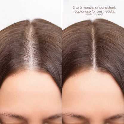 ✨ Hair Growth Red Light Therapy Cap – Restore Thicker, Stronger Hair Naturally
