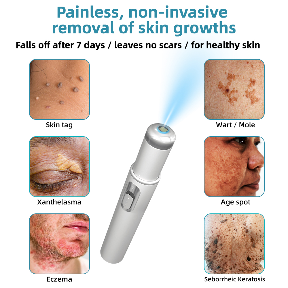 Total Skin Confidence Starts Here✨𝗞ı𝗱s𝗻𝗲𝗲𝗱® 𝗡𝗼𝗻-𝗜𝗻𝘃𝗮𝘀𝗶𝘃𝗲 𝗠𝗼𝗜𝗲 𝗮𝗻𝗱 𝗪𝗮𝗿𝘁 𝗥𝗲𝗺𝗼𝘃𝗮𝗜 𝗜𝗮𝘀𝗲𝗿 𝗣𝗲𝗻👨‍⚕️