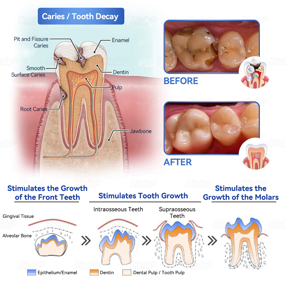𝑃𝑖𝑐𝑑𝑜® 𝑆𝑡𝑒𝑚 𝐶𝑒𝑙𝑙 𝐺𝑖𝑛𝑔𝑖𝑣𝑎𝑙 𝑅𝑒𝑝𝑎𝑖𝑟 𝑀𝑜𝑢𝑠𝑠𝑒👩‍⚕️(Promote Tooth Regrowth • Remove Tartar • Strengthen Gums • Deep Clean & Freshen Breath) 🦷